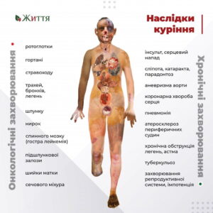 МІЖНАРОДНИЙ ДЕНЬ ВІДМОВИ ВІД КУРІННЯ: НАЙКРАЩЕ РІШЕННЯ ДЛЯ ВАШОГО ЗДОРОВʼЯ — ПРИПИНИТИ КУРИТИ ПРЯМО СЬОГОДНІ!